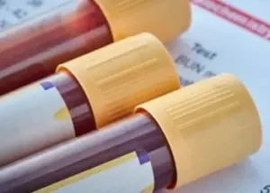 VIALAB. Laboratorio Análisis Clínicos en Sevilla 5 laboratorio analisis clinicos sevilla